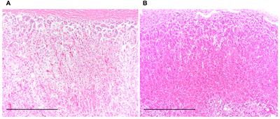 Accelerated telomere shortening in adrenal zona reticularis in patients with prolonged critical illness